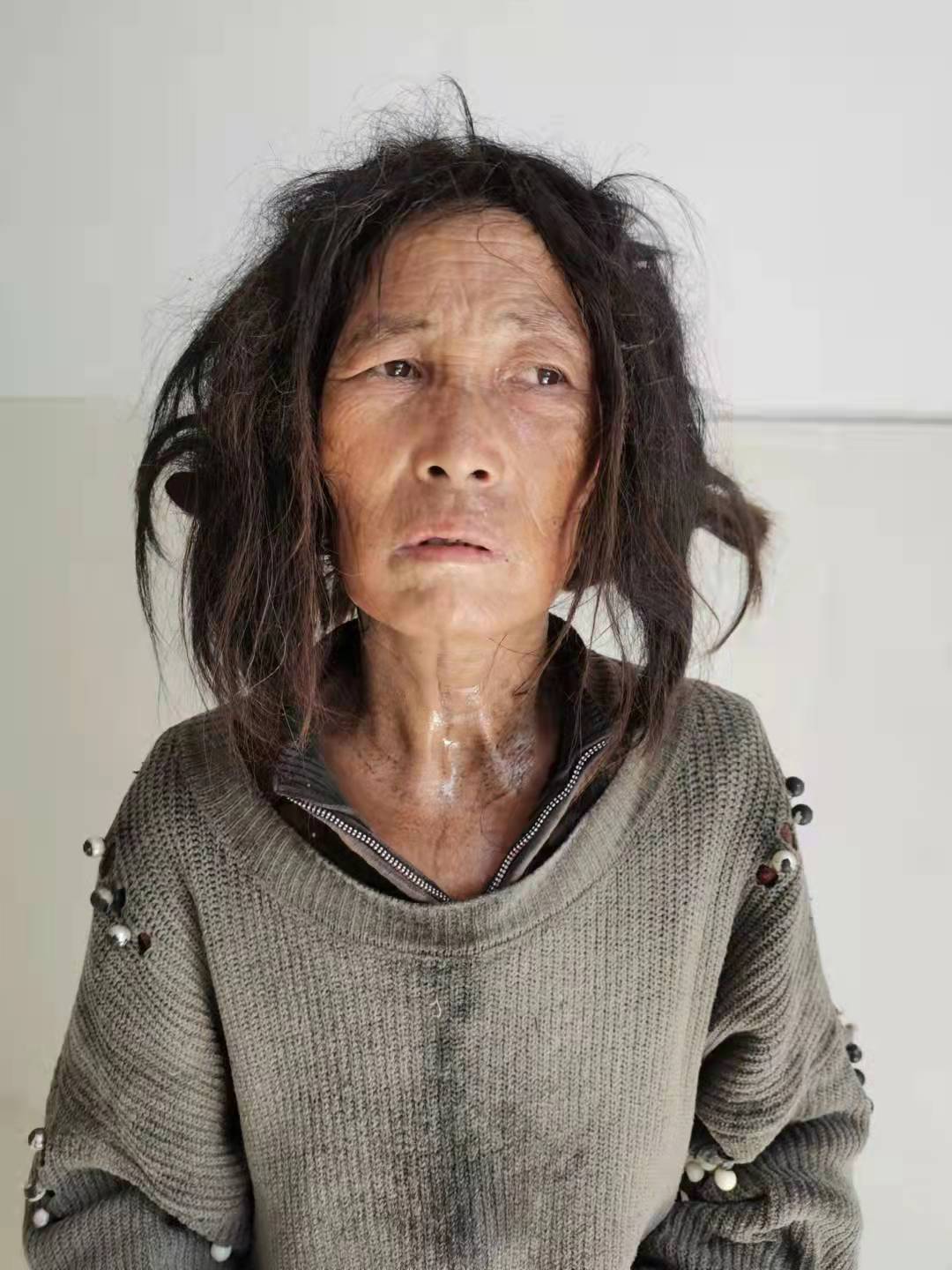 走失者照片 郴州寻亲：五旬女子被救助，穿灰色外...