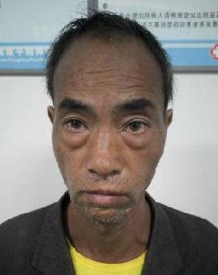走失者照片 赣州寻亲：六旬老人被救助，系流浪人...