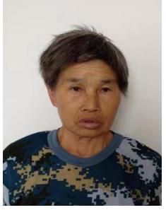 走失者照片 上饶寻亲：五旬女子被救助，穿白色衬...
