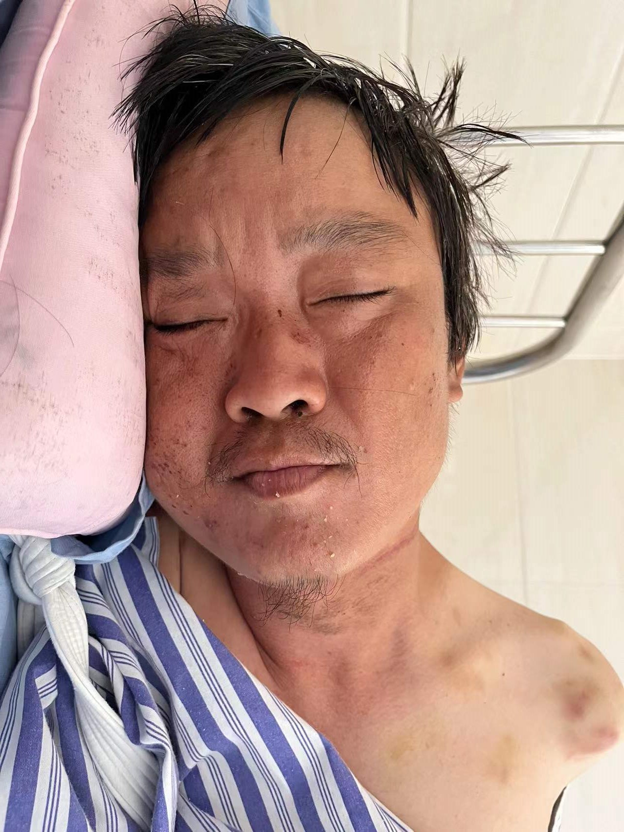 走失者照片 海口寻亲：青年男子被救助，自述叫柯...