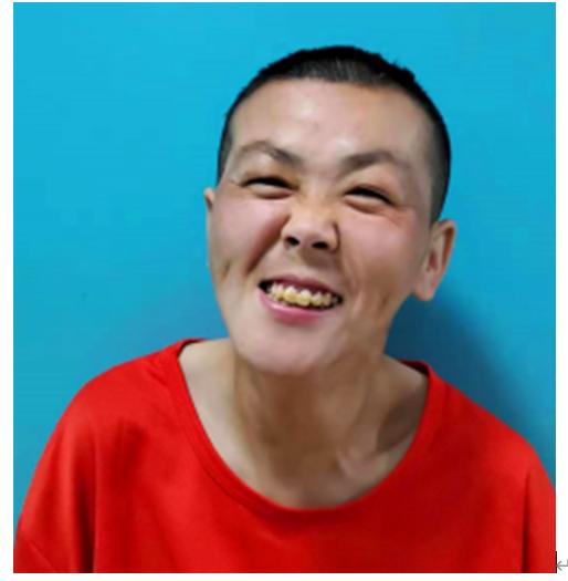 走失者照片 北京寻亲：青年女子被救助多年，疑似...
