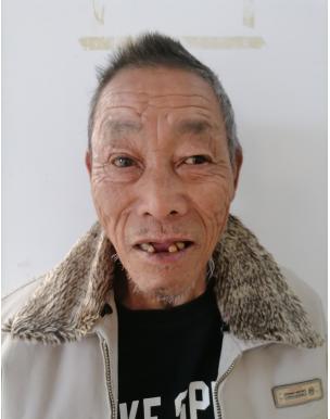走失者照片 龙岩寻亲：七旬老人被救助，自述叫陈...