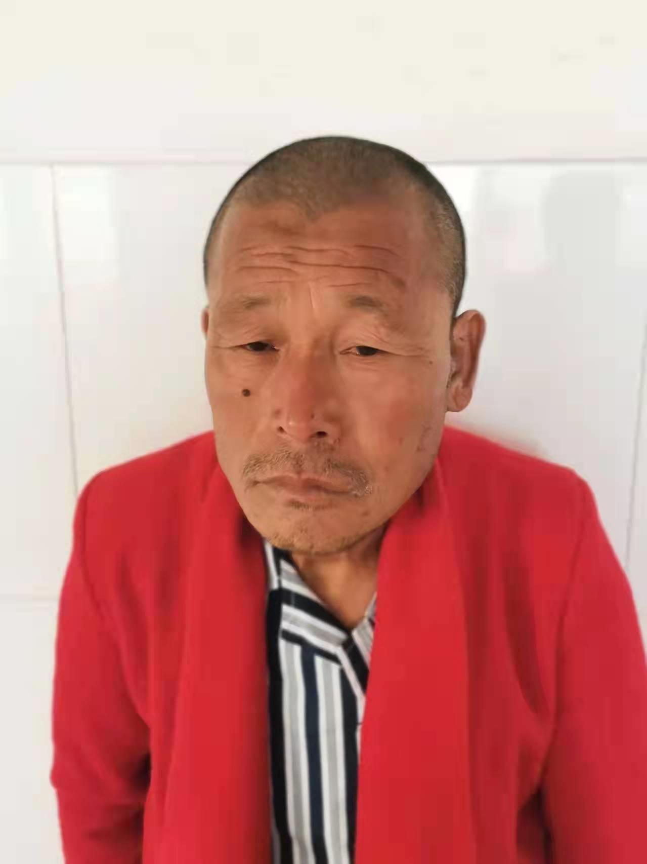 走失者照片 潍坊寻亲：安丘五旬男子被救助，右脸...