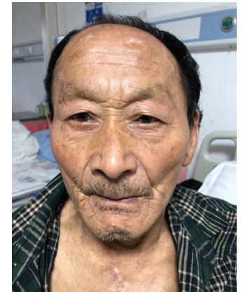 走失者照片 昆明寻亲：七旬老人被救助，自述叫李...