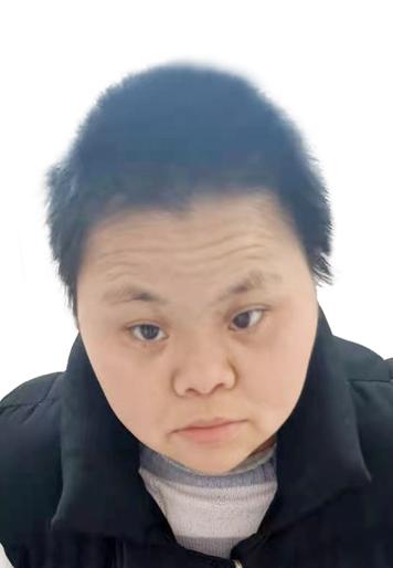 走失者照片 来宾寻亲：青年女子被救助，高1米3...