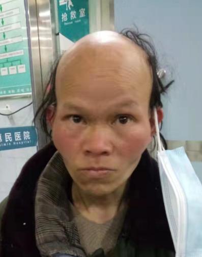 走失者照片 急寻家属！濮阳五旬女子被救助， 秃...