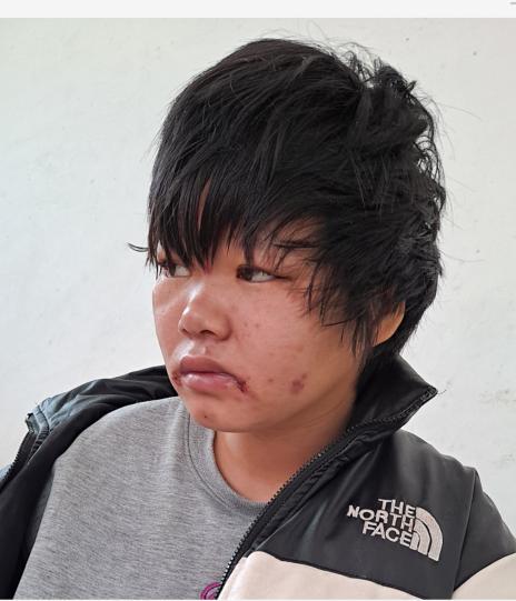走失者照片 邯郸寻亲：19少女被救助，穿黑白拼...