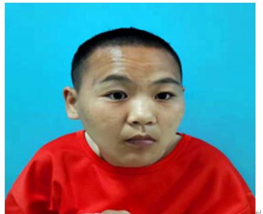 走失者照片 北京寻亲：青年女子被救助，智力异常