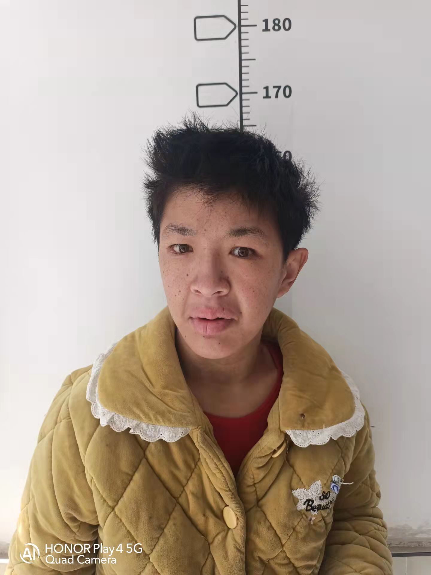 走失者照片 阜阳寻亲：中年女子被救助多年，精神...