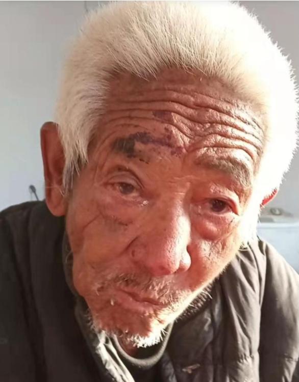 走失者照片 日照寻人！八旬老人外出失联，右眉有...