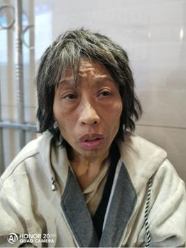 走失者照片 南阳寻亲：中年女子被救助，穿白色毛...