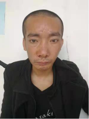 走失者照片 玉林寻亲：青年男子被救助，高1米6...