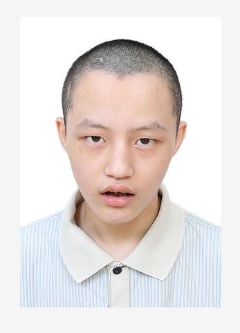 走失者照片 寻找亲属：青年男子在佛山被救助多年...