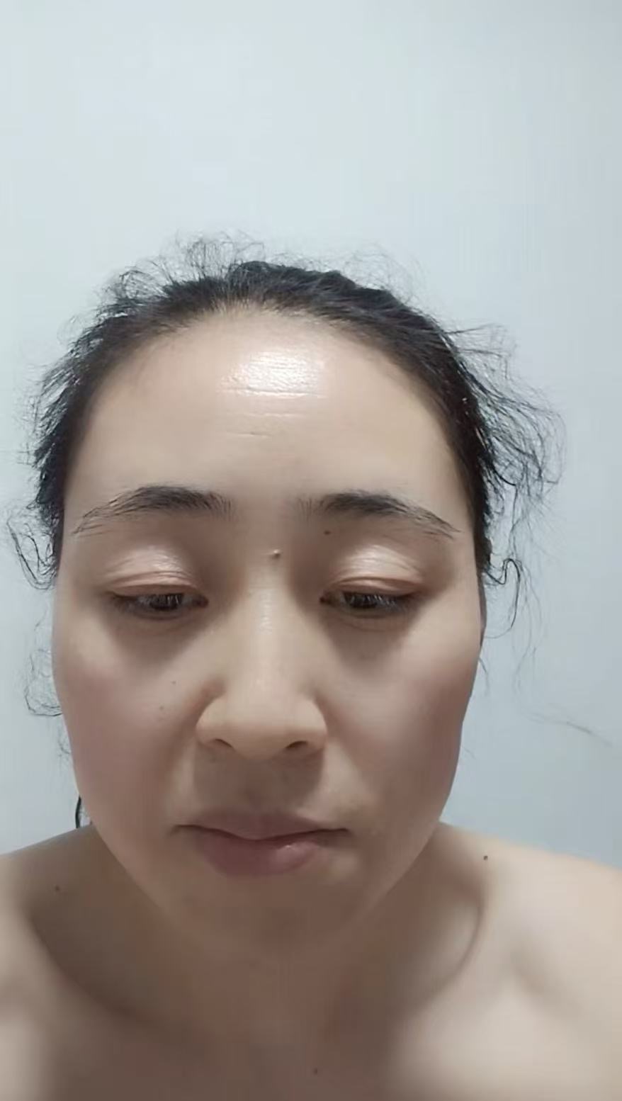 走失者照片 此人在北京失联，身患严重传染病，看...