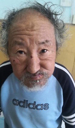 走失者照片 哈尔滨寻亲：六旬老人被救助，穿黄色...