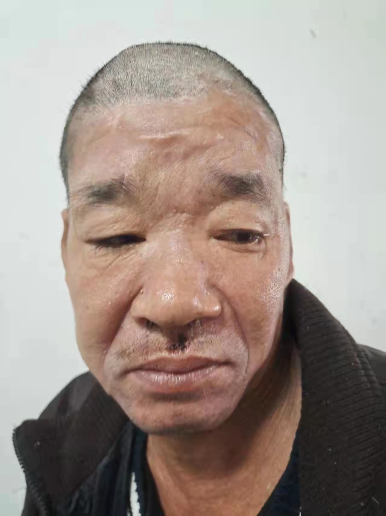 走失者照片 永州寻亲：五旬男子被救助，穿黑色外...