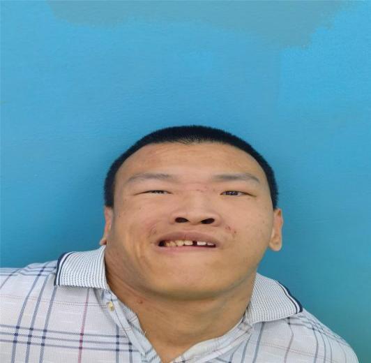 走失者照片 寻亲：青年男子在北京被救助多年，智...