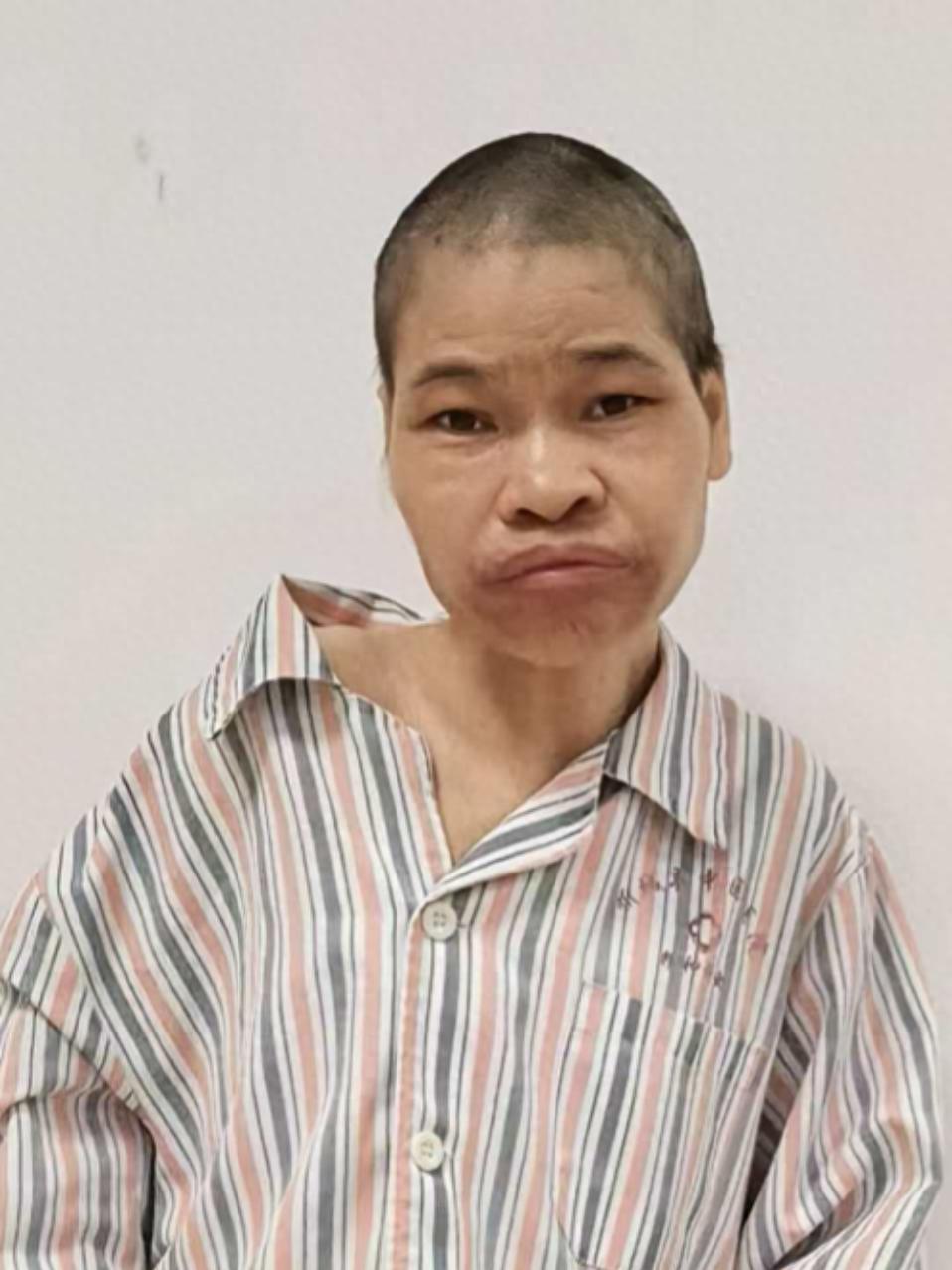 走失者照片 来宾市寻亲：中年女子因病医治无效身...