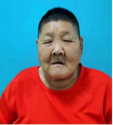 走失者照片 北京寻亲：五旬女子被救助数年，患智...