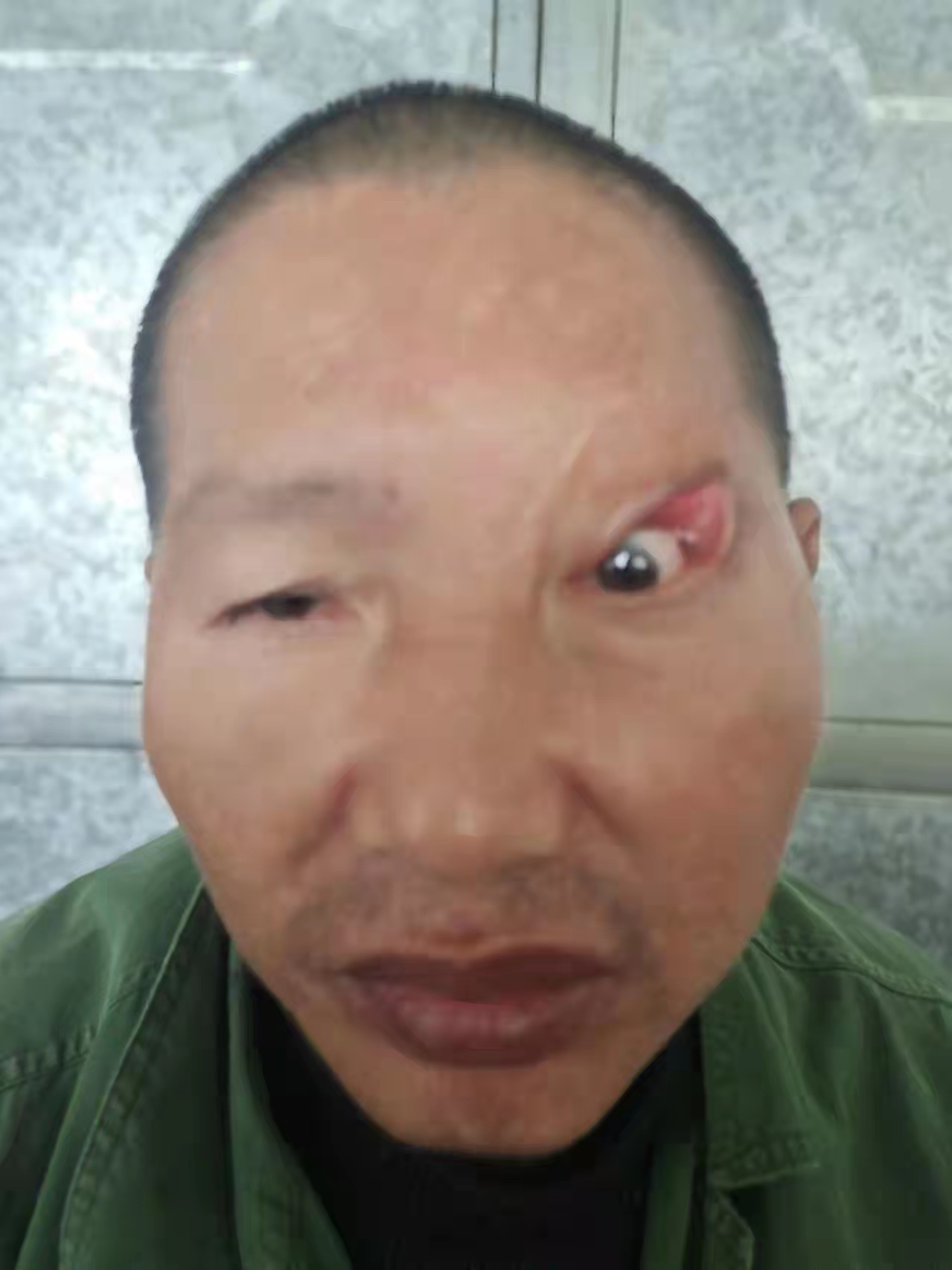 走失者照片 永州寻亲：五旬男子被救助，穿橘色皮...