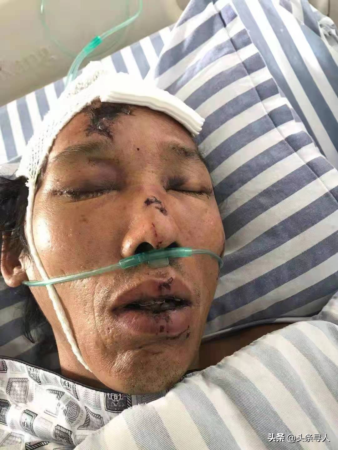走失者照片 无名患者寻亲：五旬男子在贵港桂平市...