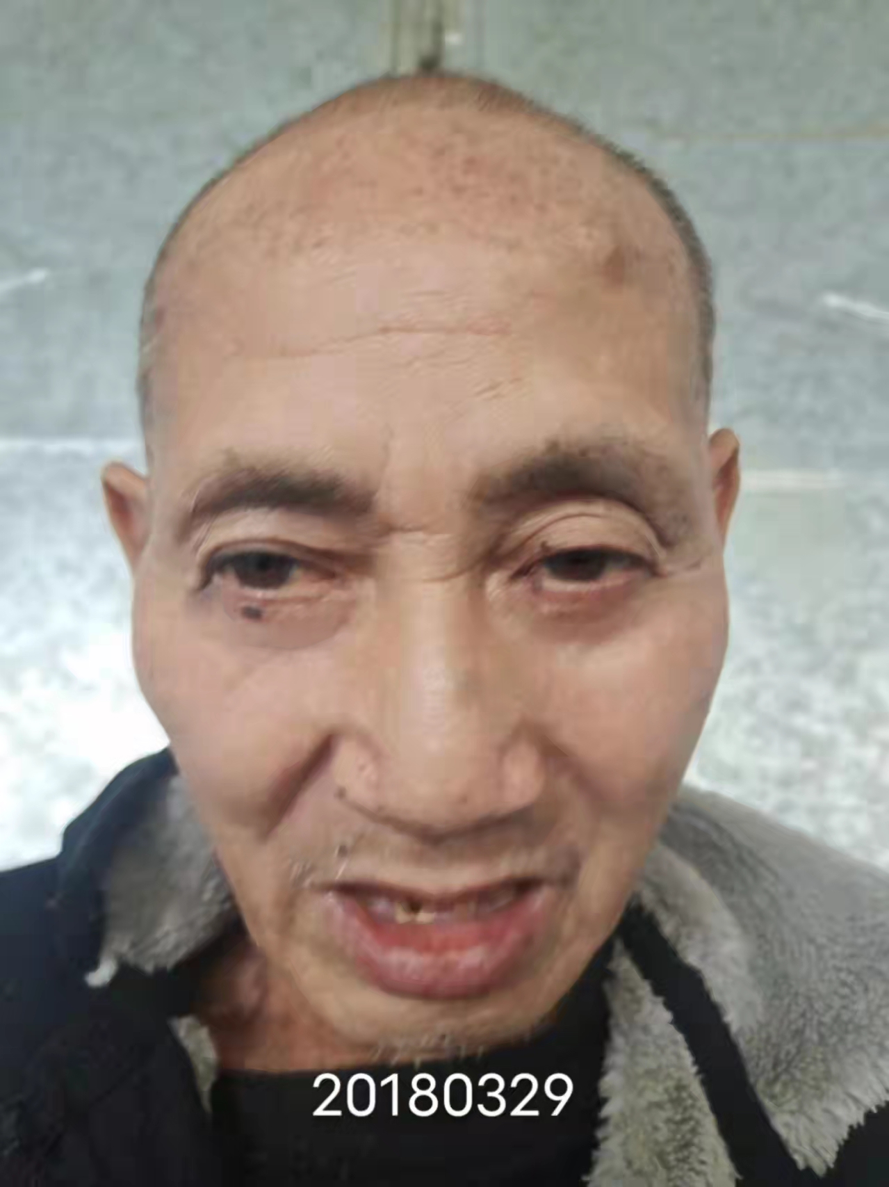 走失者照片 谁家老人走丢了？永州市八旬老人被救...