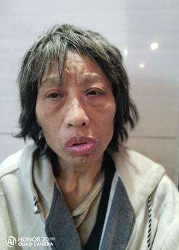 走失者照片 南阳寻亲：中年女子被救助，穿白色毛...