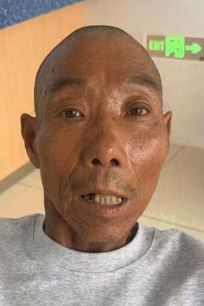 走失者照片 全国救助站