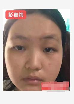 走失者照片 茂名急寻：18岁女生失联，患抑郁症...