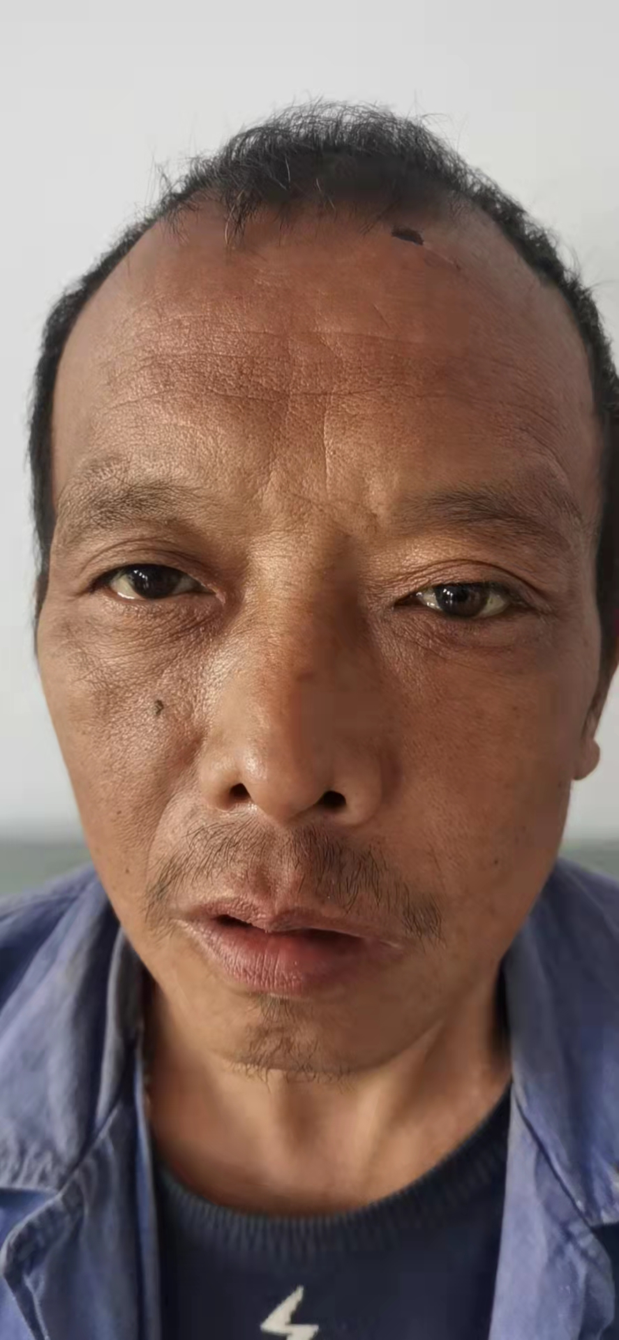 走失者照片 渭南寻亲：中年男子在韩城被救助，自...