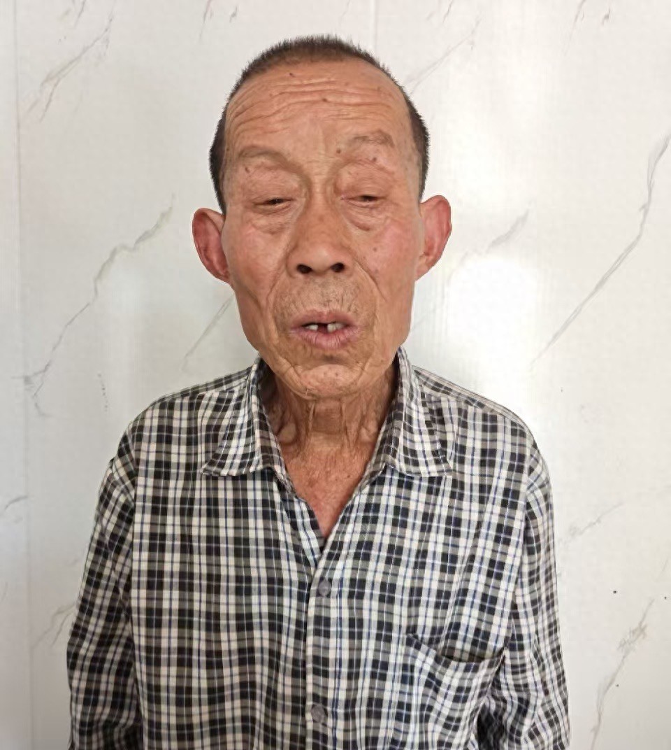 走失者照片 阜阳市寻人：七旬老人走失，穿黑色外...