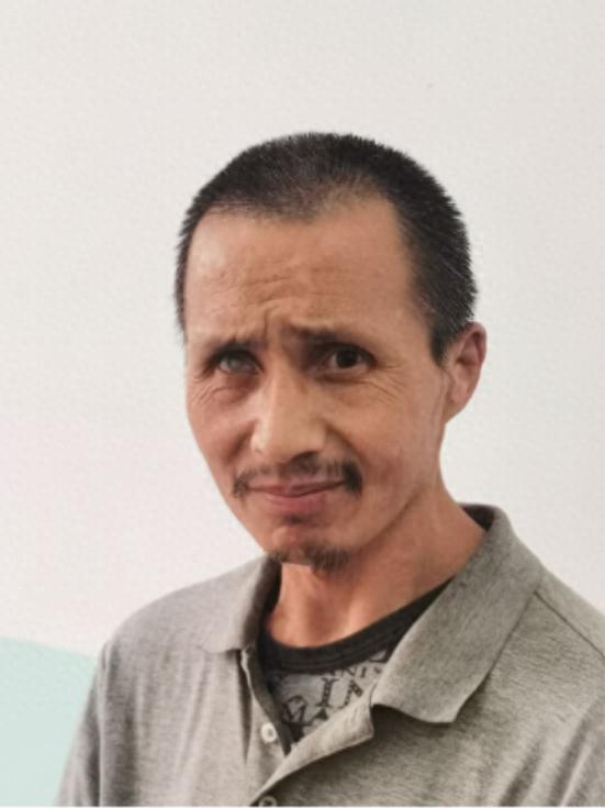 走失者照片 延边寻亲：六旬老人被救助，右眼患白...