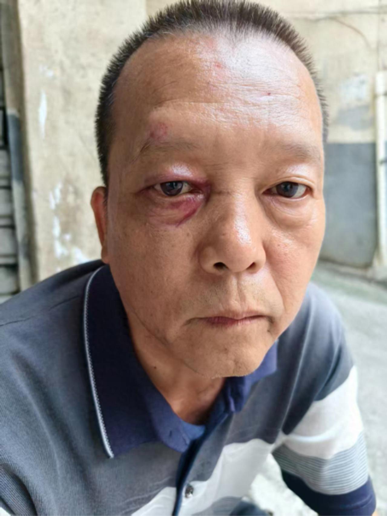 走失者照片 黔西南州寻人：五旬男子走失，患脑梗...