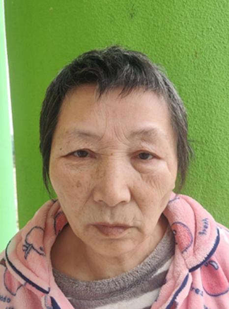 走失者照片 阜阳寻亲：六旬老太被救助多日，右脸...