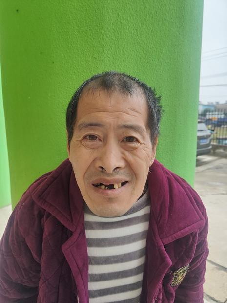 走失者照片 阜阳寻亲：五旬男子被救助多日，谢顶...