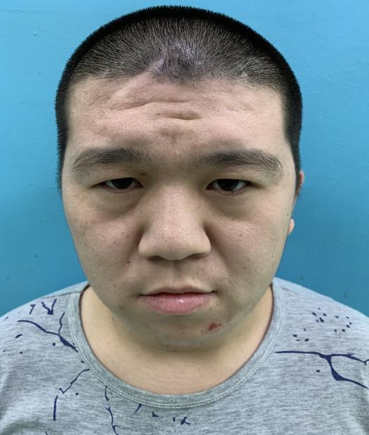 走失者照片 寻亲：中年男子在北京被救助，智力异...